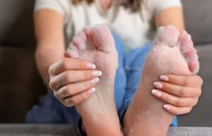 क्या हमेशा ठंडे रहते हैं आपके पैर? जानें कारण, लक्षण और इलाज